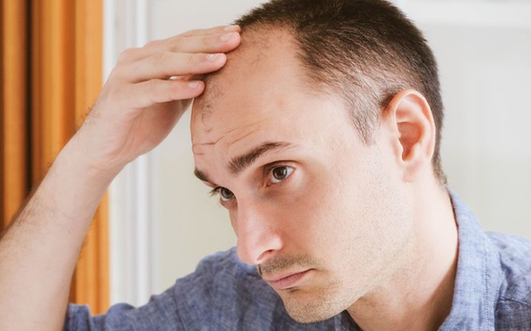Sind Haartransplantationen bei Männern erst ab einem bestimmten Alter sinnvoll?