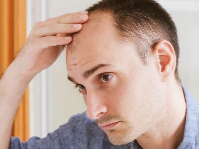 Sind Haartransplantationen bei Männern erst ab einem bestimmten Alter sinnvoll?